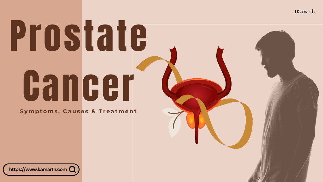 Prostate Cancer